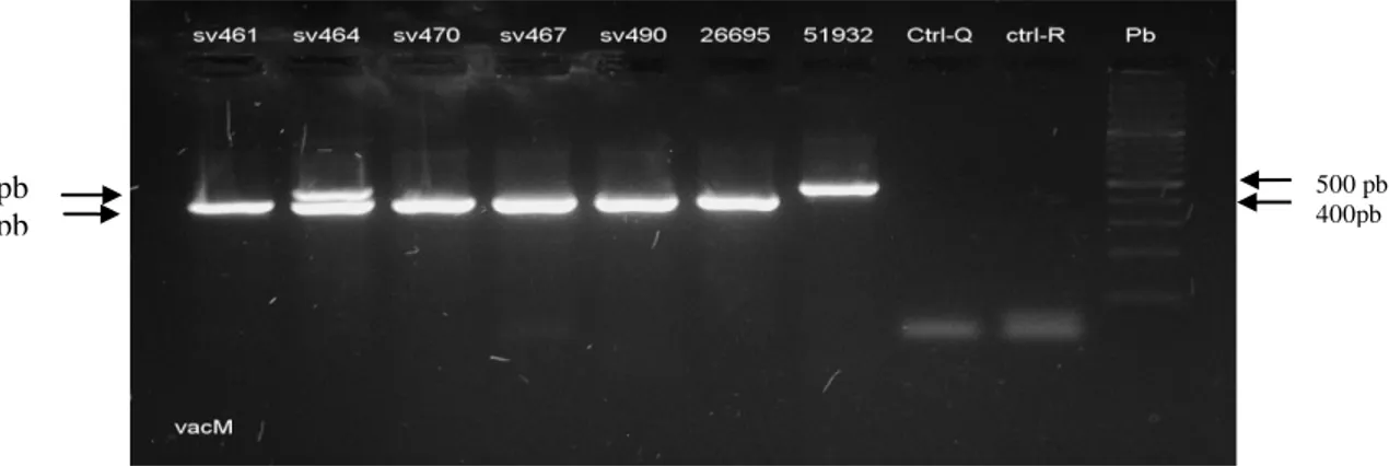 Figura  5.    Electroforesis    de  productos  de  amplificación  por  PCR  de  los  alelos  s1/s2  del  gen vacA