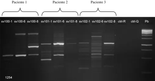 Figura  6.  Perfiles  representativos  del ADN  cromosómico  de  Helicobacter  pylori,  aislado  de  los  pacientes  de  las  poblaciones  de  estudio  obtenido  con  RAPD-PCR  con  el  primer  1254, los carriles Ctr-R y Ctr-Q son controles de amplificació
