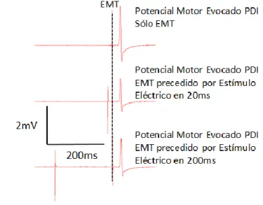 Figura  3.  Reducción  de  la  amplitud  del  potencial  evocado  motor  (PEM)  registrado  mediante  EMT  cuando se aplica un estímulo eléctrico con una anticipación de 20 ms (IAC) o 200 ms (IAL)