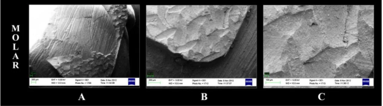 Figure 7. Representation of SEM images of the fractured enamel surface of a molar specimen bonded with Wave MV Flow without  adhesive at 5 kV: (A) 50, (B) 100, and (C) 500 times magnification