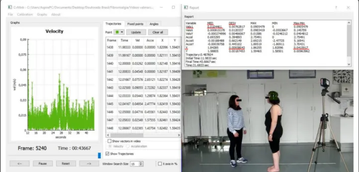 Fig. 2 Analysis and data extraction for the oscillation around the AP axis in Romberg ’s test