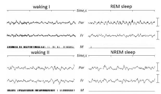 Figura I. EEG de un ratón en distintos estados de vigilia y de sueño.
