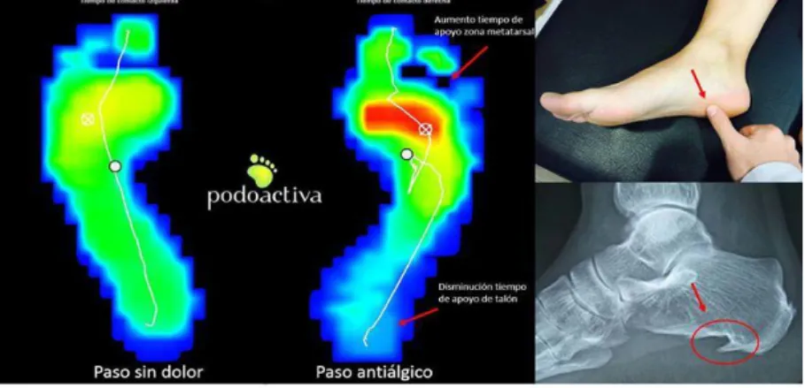 Figura 3: Diagnóstico de FP 