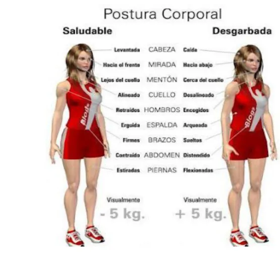 Figura 2. Modelo postural correcto