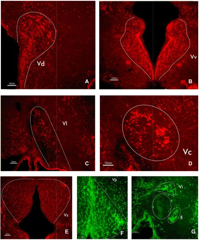 Figura  9.  Microfotografías  de  secciones  transversales  del  telencéfalo Chelon labrosus