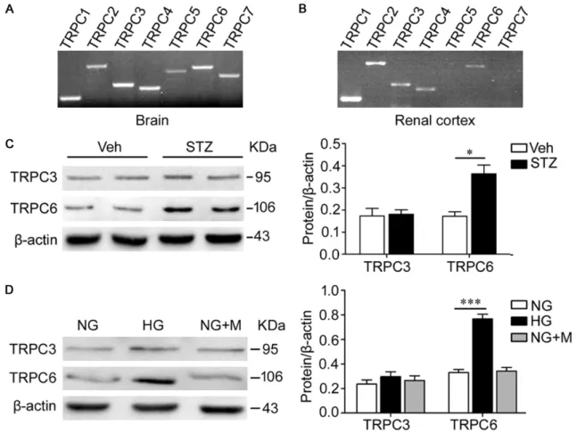 Figure 1. Hyperglycemia (high glucose) increases TRPC6. A, B. RT-PCR showed that TRPC1, TRPC2, TRPC3, TRPC4  and TRPC6 were expressed in the mouse renal cortex, while TRPC5 and TRPC7 were not detectable