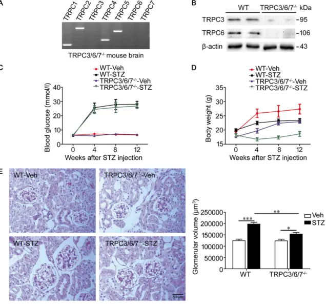 Figure 1A demonstrates the presence of mRNA  for TRPC1-TRPC7 in the mouse brain (positive  controls)