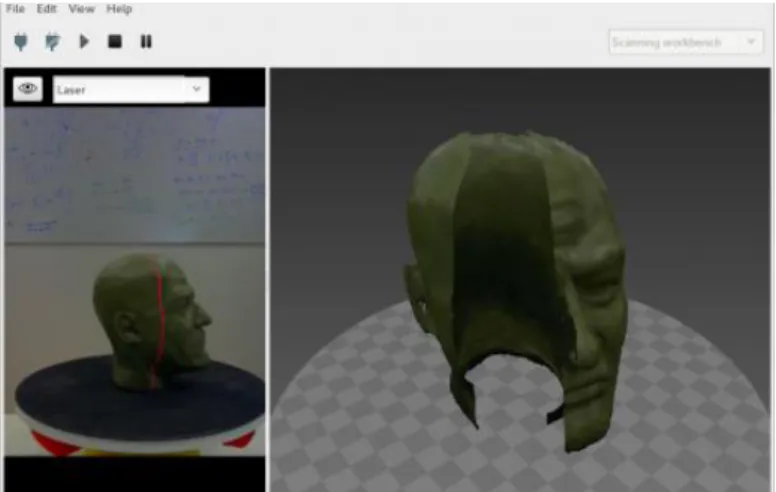 Figura 20-1 Reconstrucción con el software Horus 