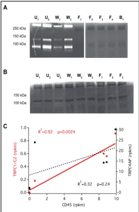 Fig. 5. Molecular analysis of RBCs. Gelatin zymography  was performed on human und murine blood samples  after 16 h digestion