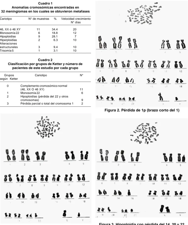 Figura 1. Monosomía del cromosoma 99 22Cuadro 1