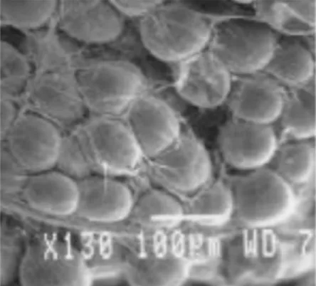 Figura 1. Microfotografía de tejido adiposo (Cortesía E. Solarte)