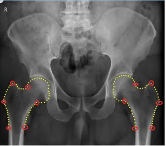 Fig. 2.  The  reference  points   were  placed  along  the proximal  femur;  considering  as  key  points   of reference  those that are  in  places  with  high  curvature  (points  enclosed  in  red  color)