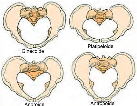 Figura 2.7. Los cuatro tipos principales de pelvis según la clasificación de Caldwell y  Moloy