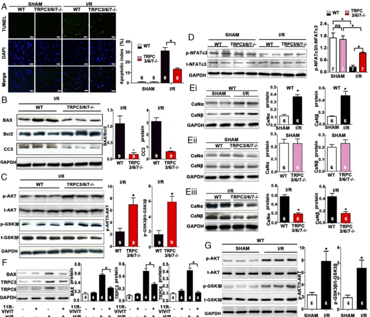 Fig. 5. Injury caused in vivo by I/R involves a positive-feedback loop mediated by NFATc3 ’s transcription of BAX and TRPC genes and is ameliorated by the ablation of TRPC3 and TRPC6
