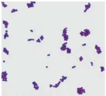 Figura 3-1. Tinción Gram de Staphylococcus aureus                                  Fuente: (Harvey, Champe y Fisher, 2008)
