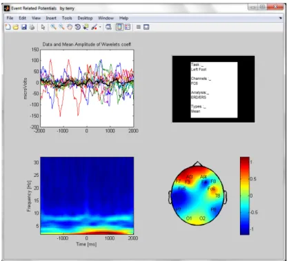 Figura 4.2: Modo de an´alisis para ERD/ERS, representaci´on topogr´afica