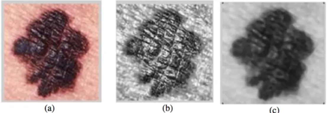 Figura 3.2: Pre-procesamiento tradicional de una imagen - (a) Imagen Original. (b) Con- Con-traste mejorado