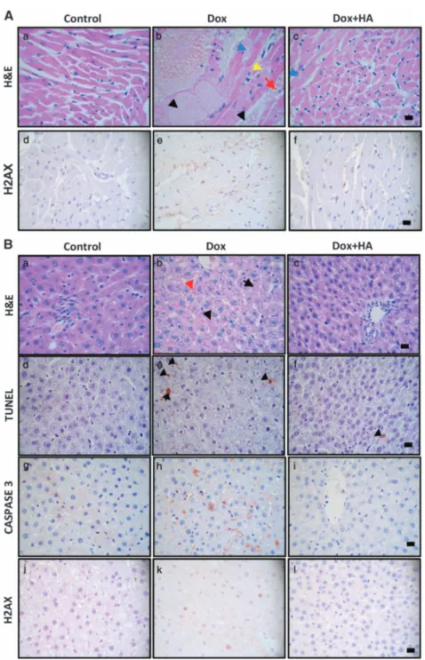 Figure 1. Histamine decreases doxorubicin-induced cardiotoxicity and hepatotoxicity in rats and mice