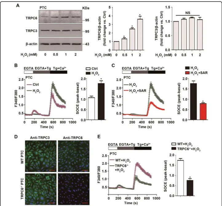 Fig. 1 Oxidative stress increases TRPC6 expression and triggers Ca 2+ in ﬂux via TRPC6-mediated store-operated Ca2+ entry (SOCE).