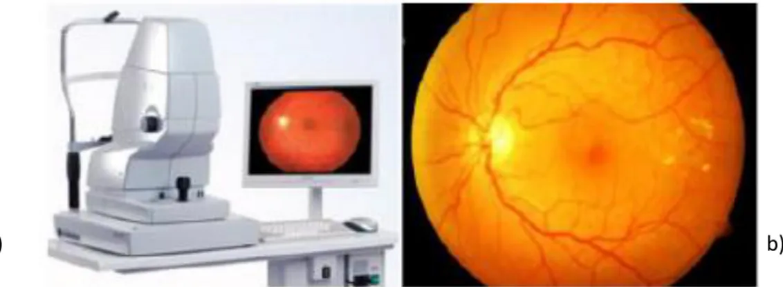 Figura 1.11 a) Cámara de fondo de ojo de la marca Carl Zeiss 17  b) retinografía a color 18