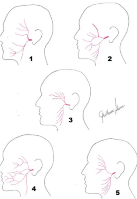 Figura  7.  Tipos  de  ramificaciones  terminales  del facial: (1) Clásico, (2) Anastomótico simple,  (3)  Escaleriforme  cervical,  (4)  Plexiforme,  (5) 