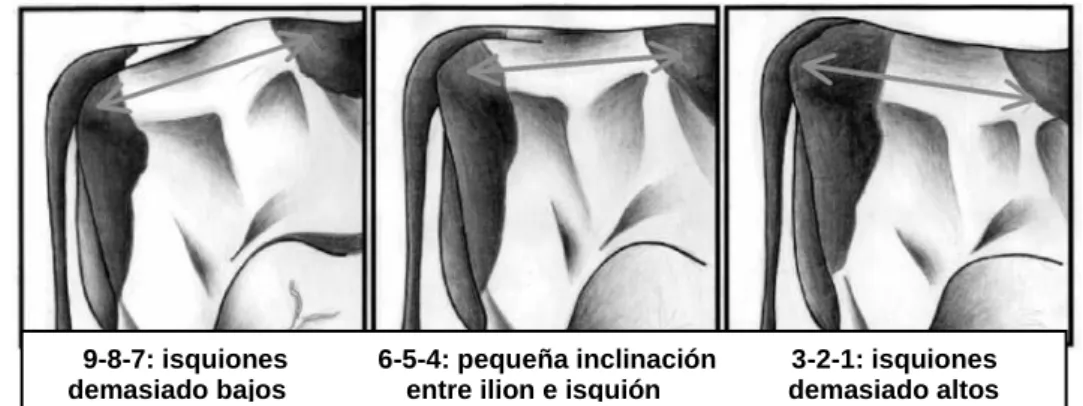 Gráfico 15.    Angulo de grupa. 