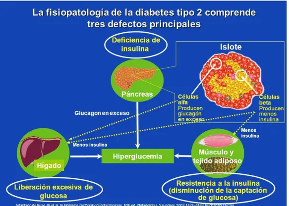 Figura I: Fisiopatologia de la Diabetes Mellitus tipo II 