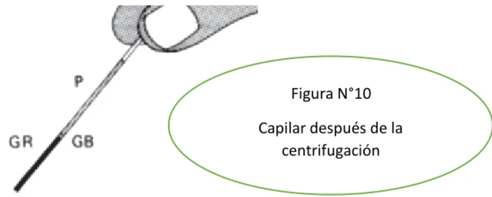 Figura N°10  Capilar después de la 