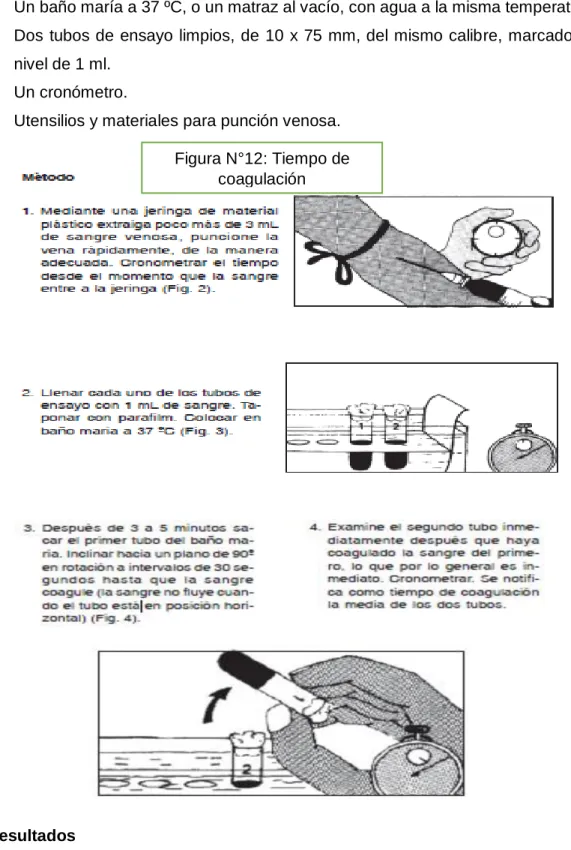 Figura N°12: Tiempo de  coagulación 