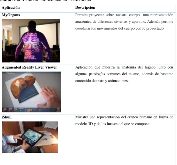 Tabla 3-2. Realidad Aumentada en la Medicina 