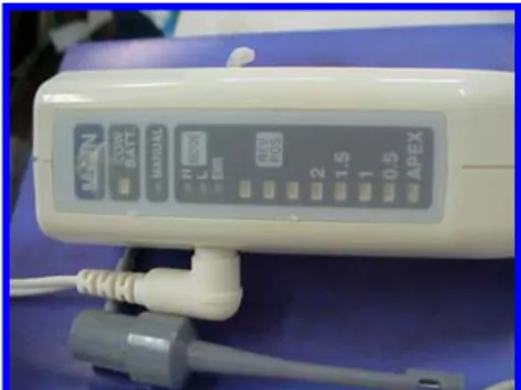 FIGURA 1 – Fios conectados.