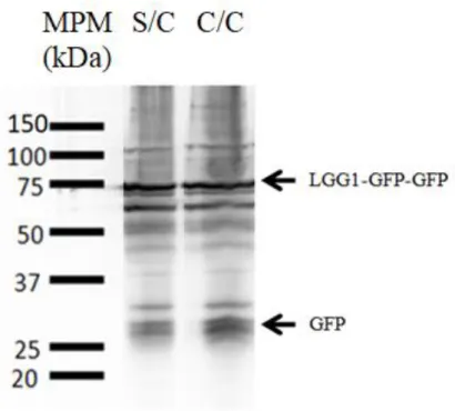 Figura  4.2:  Revelado  del  ensayo  de  Western  Blot  donde  se  representan  las  bandas  correspondientes  a  LGG1-GFP-GFP  y a GFP, en ambas condiciones sin colesterol y con colesterol, indicadas por las siglas 