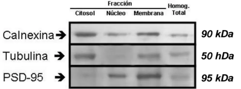 Figura  15:  Caracterización  del  contenido  proteico  de  cada  fracción  subcelular  a  través  de  la  técnica  de  western blot