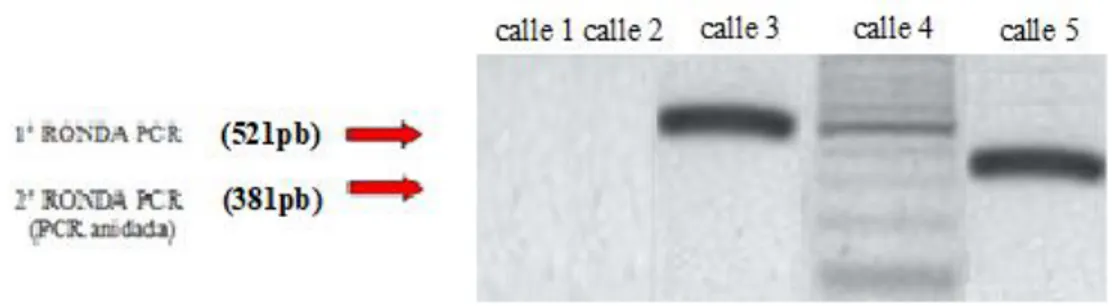 Figura 4.3.Fotografía de gel de agarosa 2 % correspondiente a electroforesis de los productos de  amplificación por PCR anidada del transcripto p190 e1-a2