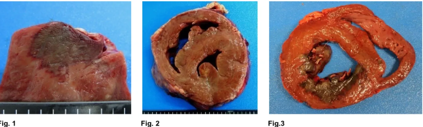 Fig. 1  Fig. 2  Fig.3 