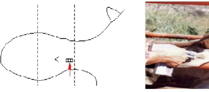Gráfico 1.   Colocación del Implante Bagó-Pell. 