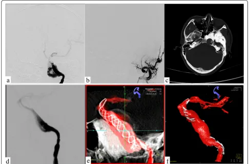 Fig. 4 Postoperative follow-up of CT and DSA. a Left internal carotid artery angiography shows the redirection of the aneurysm inflow jet