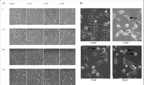 Fig. 2 a Morphological changes of ampelopsin E-treated MDA-MB-231 cells observed under an inverted light microscope (100 × magnification).Cell population decreased with the increase in the compound concentration