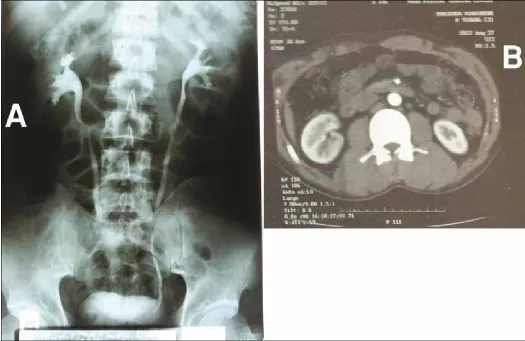 Fig. 3. A: Normal in vitro produced secretion and function, B: A computed tomography scan with intravenous contrast with normal results.