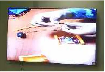 Fig 1:  Video 