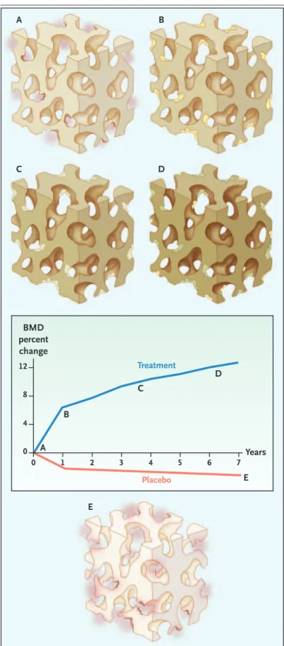 Figure 4. Effects of Antiresorptive Treatment on Bone  Remodeling.