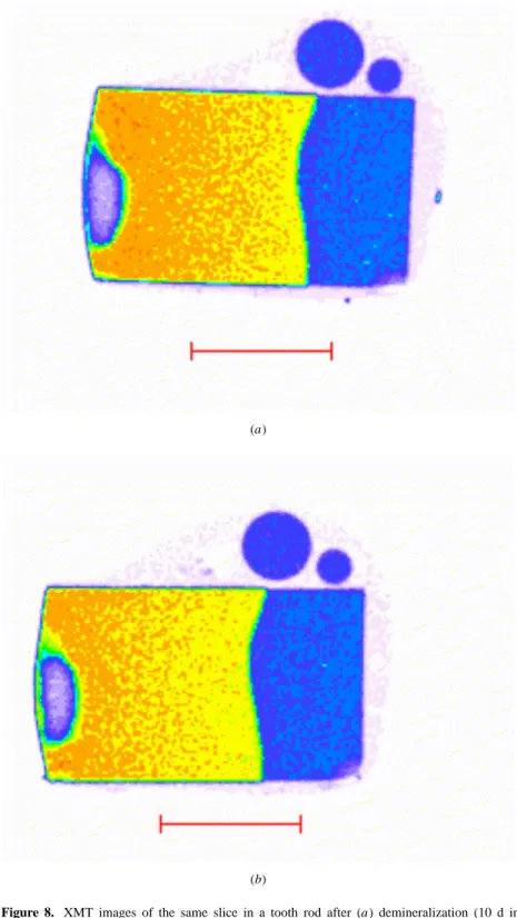 Figure 8. XMT images of the same slice in a tooth rod after (a) demineralization (10 d in a gel containing 100 mmol dm −3 ethanoic acid, 7.5 mmol dm −3 CaCl 2 and 4.5 mmol dm −3 KH 2 PO 4 , adjusted to pH 4.0 with 1 mmol dm −3 NaOH) and (b) subsequent remi