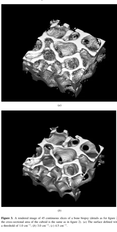 Figure 3. A rendered image of 45 continuous slices of a bone biopsy (details as for figure 2;