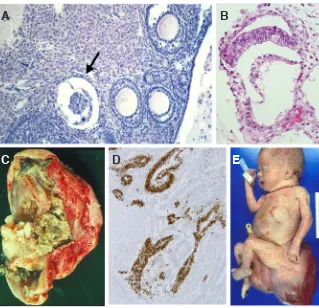 Fig. 5. Pathological images of female teratomas. (A) Parthenogenetic activation of oocytes in the ovary of Leiter (LT) mice results in the formation of preimplantation stage embryos