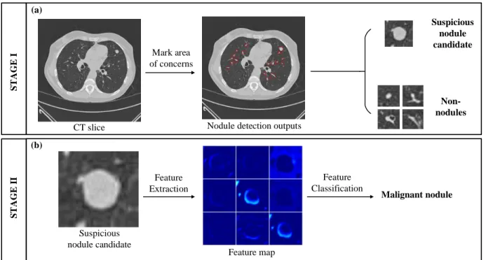 Figure 1.2: A typical CAD system to detect malignant pulmonary nodule from CT scan. (a) overview of stage 1 on nodule detection