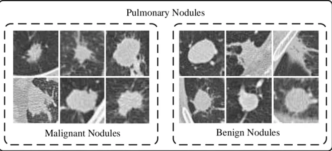 Figure 3.1: Visual representations of the pulmonary nodule patches in axial view.