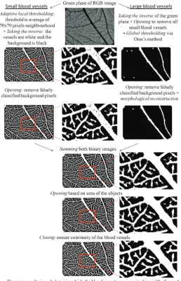 Fig. 3. Image processing. To calculate the vascular fraction and theexcept for the first and the last step which can be seen in figure with according images of a sample of embryonic day (ED) 15,software (The Mathworks Inc., Natick, USA)