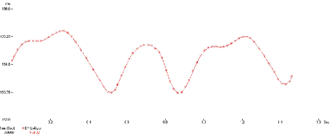 Figure 4. Vertical amplitudes of the left sitting point in free walk 