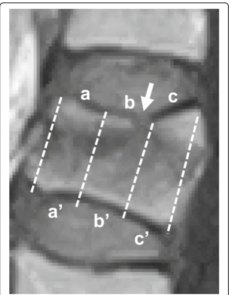 Fig. 1 Study design. Acute osteoporotic vertebral fractures (OVFs) were evaluated using magnetic resonance imaging (MRI) of cohort A and B inStudy 1