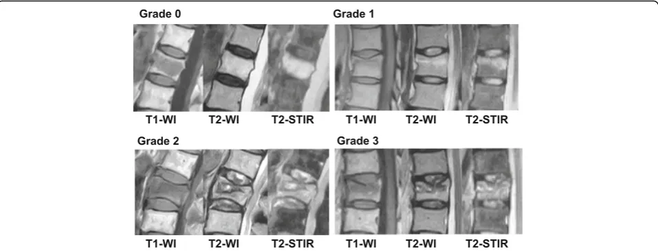 Fig. 3 Signal alternation pattern of intervertebral disc (IVD) lesions. Sagittal MR T2 short-TI inversion recovery (STIR) images were divided into fourtypes based on the signal alternation pattern (grade 0 to 3) as previously reported with modifications [2